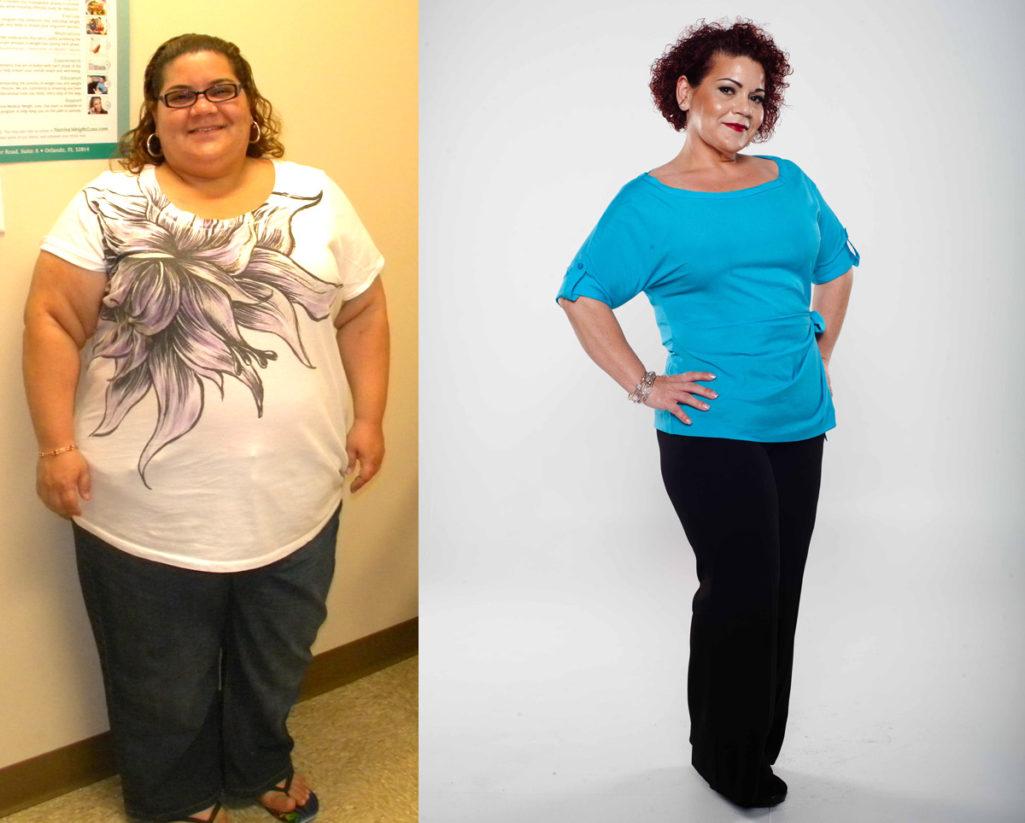 Weight Loss Christine J Before and After