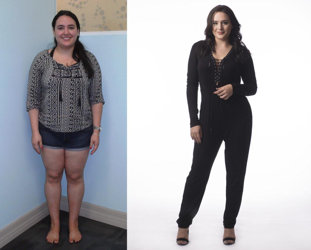 Weight Loss Lauren H Before and After