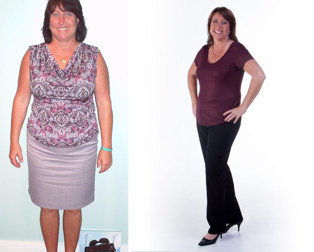 Weight Loss Lynn L Before and After