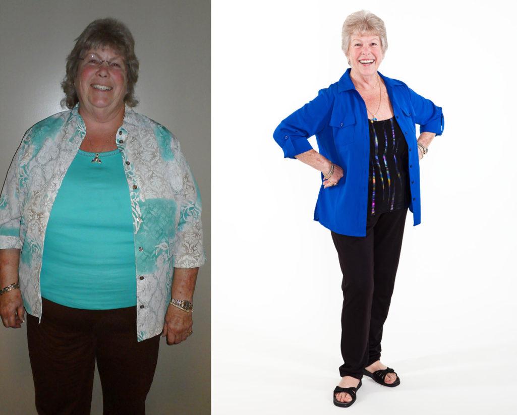 Weight Loss Patti L Before and After