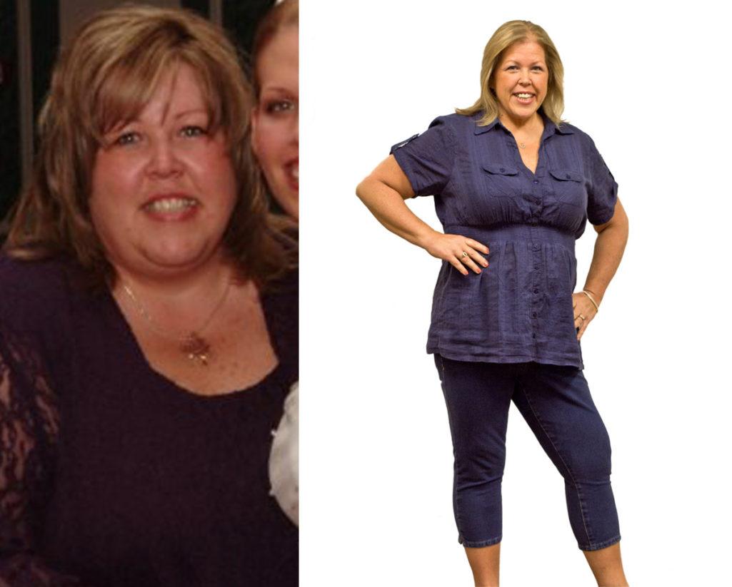 Weight Loss Sue J Before and After