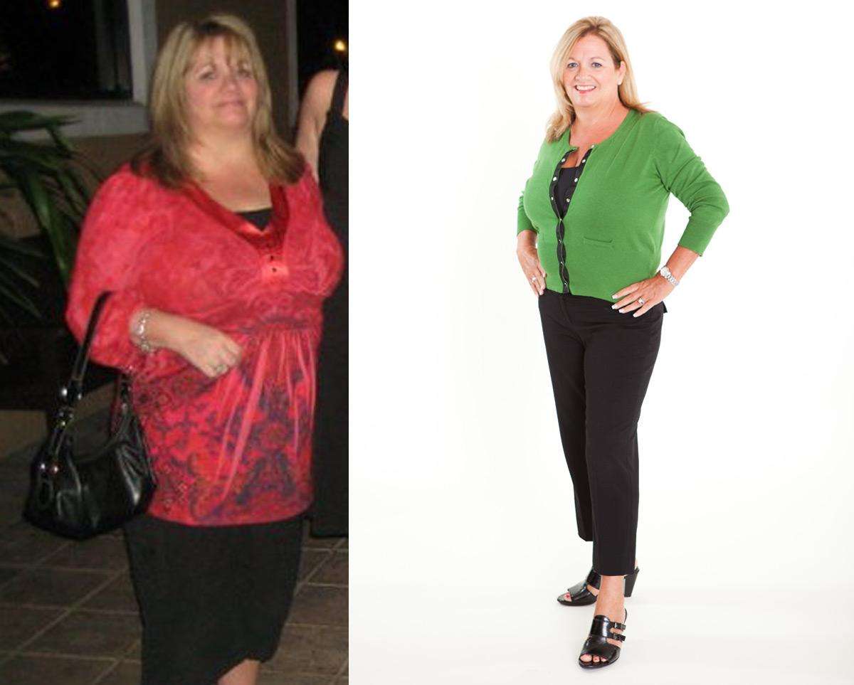 Weight Loss Diane E Before And After