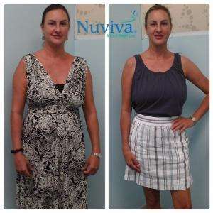 Weight Loss Laura 21