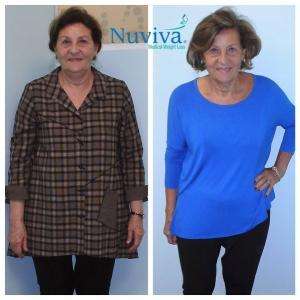 Weight Loss Magdah 38.2