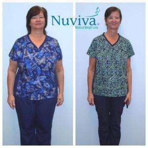 Weight Loss Lucinda 89.2 lbs