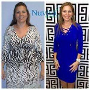 Weight Loss Naples Sheryl