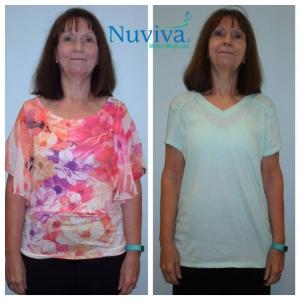 Weight Loss BA Cheryl