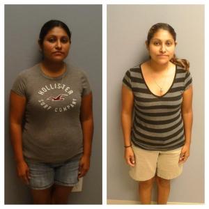 Weight Loss BA Conchita Nap