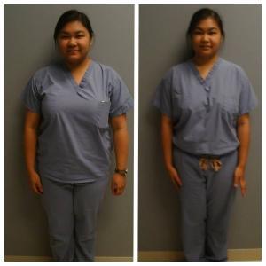 Weight Loss BA Dadeth Nap