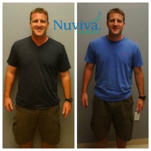Weight Loss BA Diana Nap