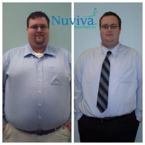 Weight Loss BA Fort Myers client