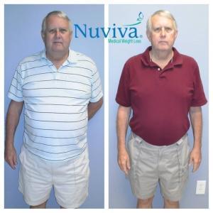 Weight Loss BA James Nap