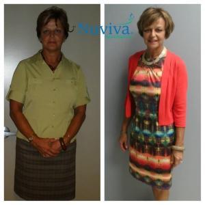 Weight Loss BA Jennie Nap