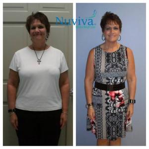 Weight Loss BA Johanna Nap