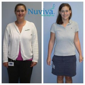 Weight Loss BA Kimberly Nap