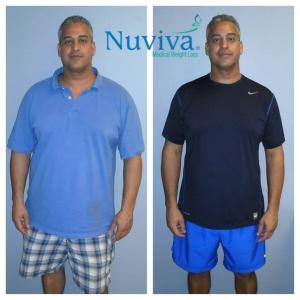 Weight Loss BA Luciano Nap