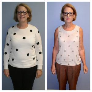 Weight Loss BA Rene Nap