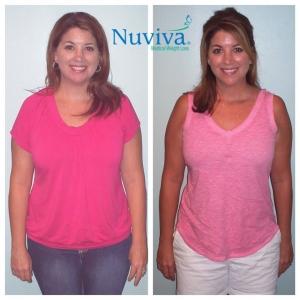Weight Loss BA Renee Bran