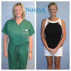 Weight Loss BA Ruth Nap