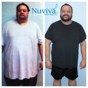 Weight Loss BA Scott Alta