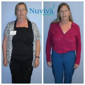 Weight Loss BA Stacey Nap