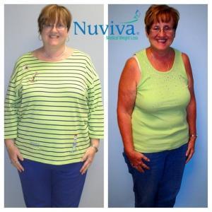 Weight Loss BA Terry Nap
