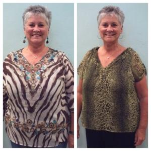 Weight Loss Fort Myers Pamela