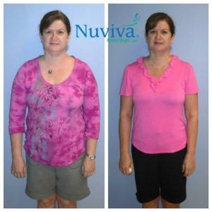 Weight Loss BA Ann Nap
