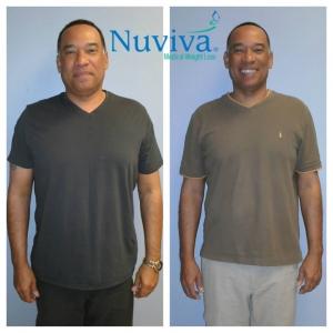 Weight Loss BA Axel Nap