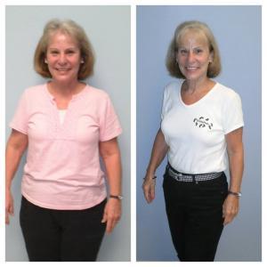 Weight Loss BA Brenda Nap