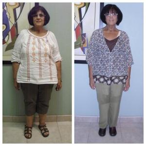 Weight Loss BA Carole Boca