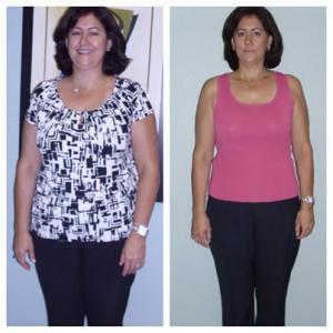 Weight Loss Alma Boca