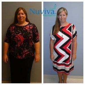 Weight Loss BA Kelly Nap
