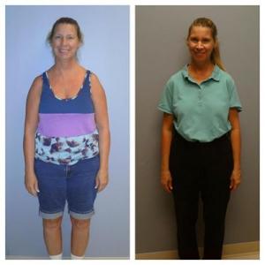 Weight Loss Carol Naples