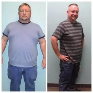 Weight Loss Craig Alta