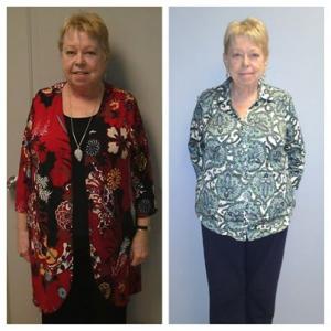 Weight Loss Jacqueline Nap